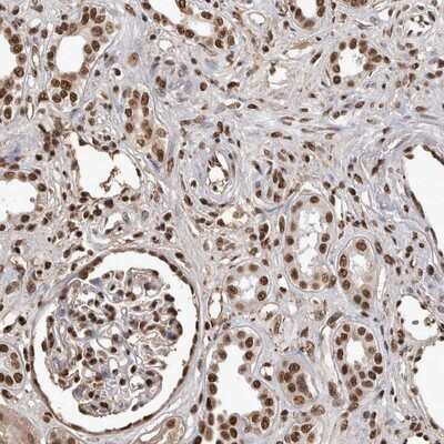 Immunohistochemistry-Paraffin: PIMT Antibody [NBP1-92271] - Staining of human kidney shows strong nuclear positivity in tubule and glomerular cells.