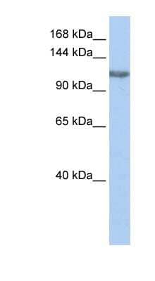 Western Blot: PIMT Antibody [NBP1-54942] - Titration: 0.2-1 ug/ml, Positive Control: HepG2 cell lysate.