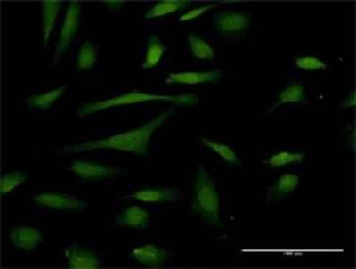 Immunocytochemistry/Immunofluorescence: PIN4 Antibody [H00005303-D01P] - Analysis of antibody to PIN4 on HeLa cell. Antibody concentration 10 ug/ml.