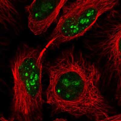 Immunocytochemistry/Immunofluorescence: PIN4 Antibody [NBP2-49132] - Immunofluorescent staining of human cell line HeLa shows localization to nucleus & nucleoli.