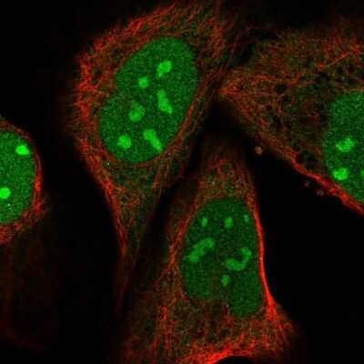 Immunocytochemistry/Immunofluorescence: PIN4 Antibody [NBP2-55773] - Staining of human cell line U-2 OS shows localization to nucleus & nucleoli.