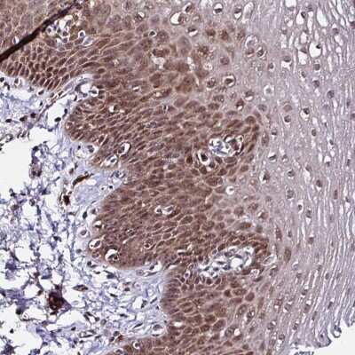 Immunohistochemistry-Paraffin: PIN4 Antibody [NBP2-49132] - Staining of human esophagus shows moderate cytoplasmic and nuclear positivity in squamous epithelial cells.