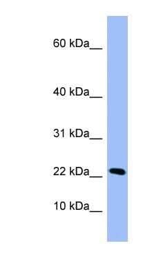 Western Blot: PIN4 Antibody [NBP1-52995] - 721_B cell lysate, concentration 0.2-1 ug/ml.