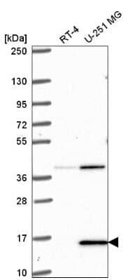 Western Blot: PIN4 Antibody [NBP2-55773] - Western blot analysis in human cell line RT-4 and human cell line U-251 MG.