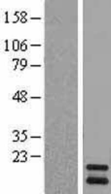 Western Blot: PIN4 Overexpression Lysate (Adult Normal) [NBL1-14429] Left-Empty vector transfected control cell lysate (HEK293 cell lysate); Right -Over-expression Lysate for PIN4.