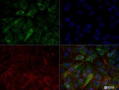 Immunocytochemistry/Immunofluorescence: PINK1 Antibody (8E10.1D6) - Azide and BSA Free [NBP2-80910] - HeLa cells were treated with valinomycin (1 uM, 24h) prior to being fixed in 10% buffered formalin for 10 min and permeabilized in 0.1% Triton X-100 in PBS for 10 min. Cells were incubated with NBP2-36488 at 50 ug/ml for 1hr at room temperature, washed 3x in PBS and incubated with Alexa-DyLight-488 anti-mouse secondary antibody. PINK1 (Green) was detected at the mitochondria. Tubulin (Red) was detected using an anti-tubulin antibody with an anti-rabbit DyLight 550 secondary antibody. DNA (Blue) was counterstained with DAPI. Note: mitochondria staining might not be easily observed without treatment with valinomycin or CCCP. Image objective 40x. Image from the standard format of this antibody.