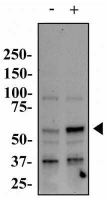 Western Blot: PINK1 Antibody (8E10.1D6) - Azide and BSA Free [NBP2-80910] - Whole cell protein from HeLa cells treated with or without valinomycin (1 uM, 24h) as indicated was separated by SDS-PAGE on a 7.5% polyacrylamide gel. Protein was transferred to PVDF membrane and probed with 2 ug/ml anti-PINK1 in 1% BSA and detected with an HRP-conjugated anti-mouse secondary antibody using chemiluminescence. PINK1 is seen to be upregulated with treament and with a molecular weight at approximately 60 kDa. Image from the standard format of this antibody.