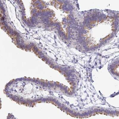 Immunohistochemistry-Paraffin: PINLYP Antibody [NBP2-32588] - Staining of human fallopian tube shows strong positivity in cilia.