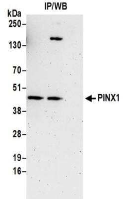 Immunoprecipitation: PINX1 Antibody [NBP2-32265] - Samples:  Whole cell lysate (0.5 or 1.0 mg per IP reaction; 20% of IP loaded) prepared using NETN buffer from Jurkat cells. Antibodies:  Affinity purified rabbit anti-PINX1 antibody NBP2-32265 used for IP at 6 ug per reaction.  PINX1 was also immunoprecipitated by rabbit anti-PINX1 antibody BL15294.  For blotting immunoprecipitated PINX1, NBP2-32265 was used at 1 ug/ml.  Detection: Chemiluminescence with an exposure time of 3 minutes.