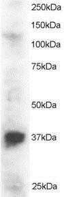 Western Blot: PINX1 Antibody [NB100-890] - (2ug/ml) of Jurkat lysate (RIPA buffer, 30ug total protein per lane). Primary incubated for 1 hour. Detected by western blot using chemiluminescence.