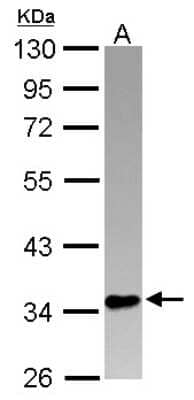 Western Blot: PINX1 Antibody [NBP2-19832] - Sample (30 ug of whole cell lysate) A: A549 10% SDS PAGE gel, diluted at 1:1000.