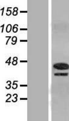 Western Blot: PINX1 Overexpression Lysate (Adult Normal) [NBL1-14430] Left-Empty vector transfected control cell lysate (HEK293 cell lysate); Right -Over-expression Lysate for PINX1.