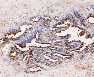 Immunohistochemistry-Paraffin: PIP Antibody (JE48-53) [NBP2-80472] - Analysis in human seminal vesicle tissue using PIP antibody. The section was pre-treated using heat mediated antigen retrieval with Tris-EDTA buffer (pH 8.0-8.4) for 20 minutes. The tissues were blocked in 5% BSA for 30 minutes at room temperature, washed