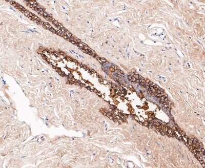 Immunohistochemistry-Paraffin: PIP Antibody (JE48-53) [NBP2-80472] - Analysis in human breast tissue using PIP antibody. The section was pre-treated using heat mediated antigen retrieval with Tris-EDTA buffer (pH 8.0-8.4) for 20 minutes. The tissues were blocked in 5% BSA for 30 minutes at room temperature, washed with ddH