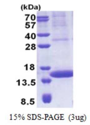 SDS-Page: Recombinant Human PIP Protein [NBP2-23366]