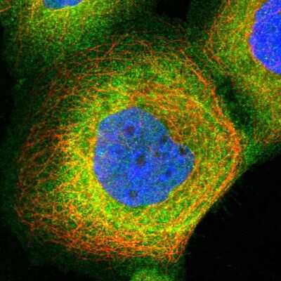 Immunocytochemistry/Immunofluorescence: PIP5K1 alpha Antibody [NBP1-90358] - Immunofluorescent staining of human cell line A-431 shows localization to plasma membrane & cytosol.