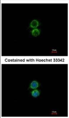 Immunocytochemistry/Immunofluorescence: PIP5K1 alpha Antibody [NBP2-19833] - Immunofluorescence analysis of methanol-fixed A549, using antibody at 1:500 dilution.