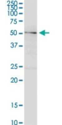 Western Blot: PIP5K1 alpha Antibody [H00008394-D01P] - Analysis of PIP5K1A expression in human pancreas.