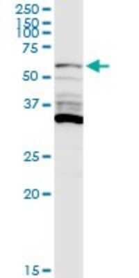 Western Blot: PIP5K1 alpha Antibody [H00008394-D01P] - Analysis of PIP5K1A expression in mouse liver.