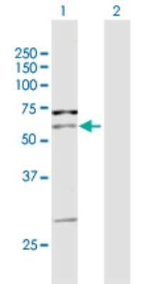 Western Blot: PIP5K1 alpha Antibody [H00008394-D01P] - Analysis of PIP5K1A expression in transfected 293T cell line by PIP5K1A polyclonal antibody.Lane 1: PIP5K1A transfected lysate(56.10 KDa).Lane 2: Non-transfected lysate.