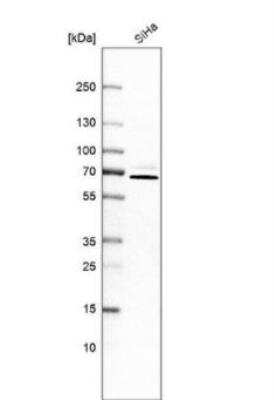 Western Blot PIP5K1 alpha Antibody