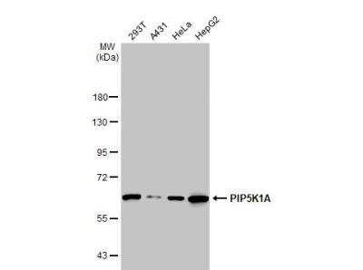 Western Blot: PIP5K1 alpha Antibody [NBP2-19833] - Various whole cell extracts (30 ug) were separated by 7.5% SDS-PAGE, and the membrane was blotted with PIP5K1A antibody [N1N3] diluted at 1:1000. The HRP-conjugated anti-rabbit IgG antibody (NBP2-19301) was used to detect the primary antibody.