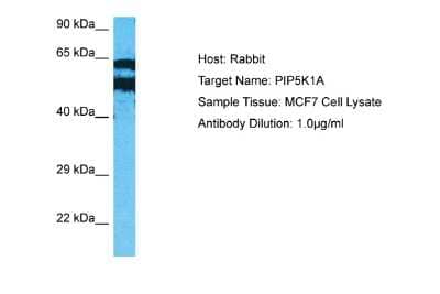 Western Blot: PIP5K1 alpha Antibody [NBP2-88052] - Host: Rabbit. Target Name: PIP5K1A. Sample Type: MCF7 Whole Cell lysates. Antibody Dilution: 1.0ug/ml