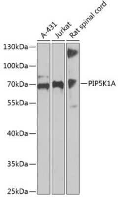 Western Blot: PIP5K1 alpha Antibody [NBP2-93251] - Analysis of extracts of various cell lines, using PIP5K1 alpha at 1:1000 dilution. Secondary antibody: HRP Goat Anti-Rabbit IgG (H+L) at 1:10000 dilution. Lysates/proteins: 25ug per lane. Blocking buffer: 3% nonfat dry milk in TBST. Detection: ECL Basic Kit . Exposure time: 90s.