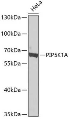 Western Blot: PIP5K1 alpha Antibody [NBP2-93642] - Analysis of extracts of HeLa cells, using PIP5K1 alpha at 1:1000 dilution.Secondary antibody: HRP Goat Anti-Rabbit IgG (H+L) at 1:10000 dilution.Lysates/proteins: 25ug per lane.Blocking buffer: 3% nonfat dry milk in TBST.Detection: ECL Basic Kit .Exposure