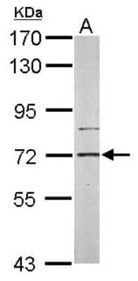 Western Blot: PIP5K1C Antibody [NBP1-32408] - Sample (50 ug of whole cell lysate) A: Mouse brain 7. 5% SDS PAGE; antibody diluted at 1:1000.