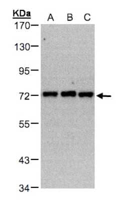 Western Blot: PIP5K1C Antibody [NBP1-32408] - Sample(30 ug whole cell lysate)A:A431 B:H1299 C:HeLa S3 7. 5% SDS PAGE, antibody diluted at 1:500.