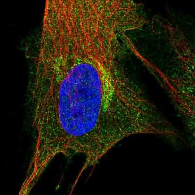Immunocytochemistry/Immunofluorescence: PIP5K2 alpha Antibody [NBP2-56952] - Staining of human cell line BJ shows localization to plasma membrane, cytosol & the Golgi apparatus.