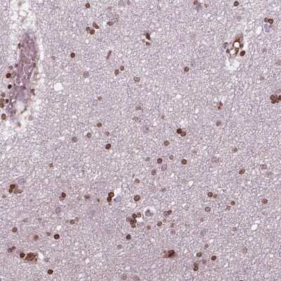 Immunohistochemistry: PIP5K2 alpha Antibody [NBP2-49566] - Staining of human cerebral cortex shows strong nuclear positivity in glial cells.