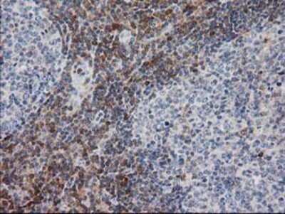 Immunohistochemistry: PIP5K2 alpha Antibody (OTI3D3) - Azide and BSA Free [NBP2-73417] - Staining of paraffin-embedded Human lymph node tissue using anti-PIP5K2 alpha mouse monoclonal antibody.