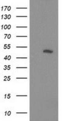 Western Blot: PIP5K2 alpha Antibody (OTI3D3) - Azide and BSA Free [NBP2-73417] - HEK293T cells were transfected with the pCMV6-ENTRY control (Left lane) or pCMV6-ENTRY PIP5K2 alpha (Right lane) cDNA for 48 hrs and lysed. Equivalent amounts of cell lysates (5 ug per lane) were separated by SDS-PAGE and immunoblotted with anti-PIP5K2 al