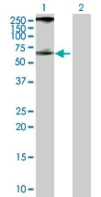 Western Blot: PIP5K2 alpha Antibody [H00005305-D01P] - Analysis of PIP4K2A expression in transfected 293T cell line by PIP4K2A polyclonal antibody.Lane 1: PIP4K2A transfected lysate(46.20 KDa).Lane 2: Non-transfected lysate.