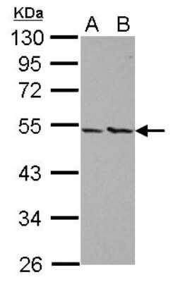 Western Blot: PIP5K2 alpha Antibody [NBP2-19834] - Sample (30 ug of whole cell lysate) A: A431 B: HeLa 10% SDS PAGE gel, diluted at 1:1000.