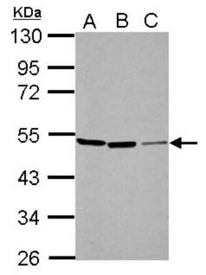 Western Blot: PIP5K2 alpha Antibody [NBP2-19834] - Sample (30 ug of whole cell lysate) A: Neuro2A B: GL261 C: C8D30 10% SDS PAGE gel, diluted at 1:1000.