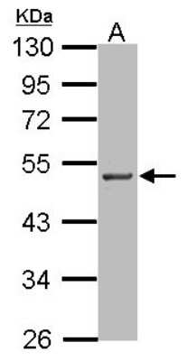 Western Blot: PIP5K2 alpha Antibody [NBP2-19834] - Sample (50 ug of whole cell lysate) A: Rat brain, 10% SDS PAGE gel, diluted at 1:1000.