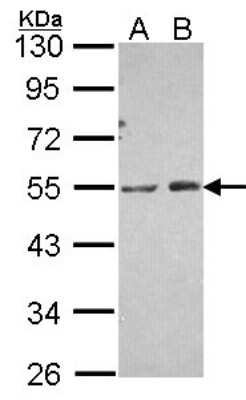Western Blot: PIP5K2 alpha Antibody [NBP2-19835] - Sample (30 ug of whole cell lysate) A: A431 B: H1299 10% SDS PAGE gel, diluted at 1:1000.