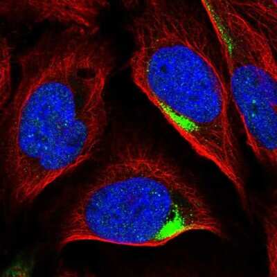 Immunocytochemistry/Immunofluorescence: PIP5K2 gamma Antibody [NBP2-56140] - Staining of human cell line U-2 OS shows localization to vesicles.