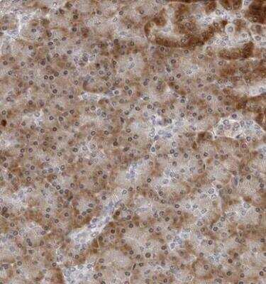 Immunohistochemistry-Paraffin PIP5K2 gamma Antibody