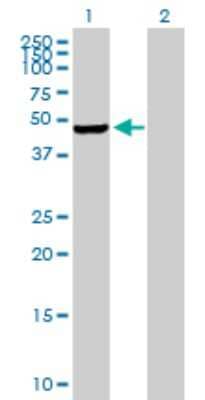 Western Blot PIP5K2 gamma Antibody