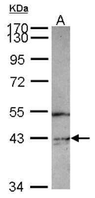 Western Blot PIP5K2 gamma Antibody