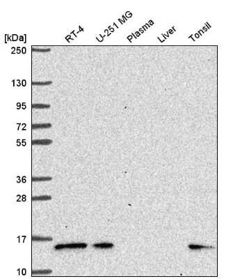 Western Blot: PIP5K2 gamma Antibody [NBP2-56140] - Western blot analysis in human cell line RT-4, human cell line U-251 MG, human plasma, human liver tissue and human tonsil tissue.