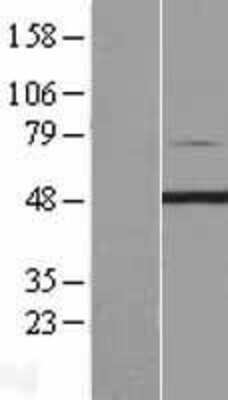 Western Blot PIP5K2 gamma Overexpression Lysate