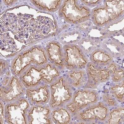 Immunohistochemistry-Paraffin: PIP5KL1 Antibody [NBP2-33779] - Staining of human kidney shows moderate cytoplasmic and membranous positivity in cells in tubules.