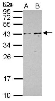 Western Blot: PIP5KL1 Antibody [NBP2-19838] - Sample (30 ug of whole cell lysate) A: NT2D1 B: PC-3 12% SDS PAGE gel, diluted at 1:1000.