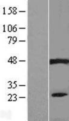 Western Blot: PIP5KL1 Overexpression Lysate (Adult Normal) [NBL1-14437] Left-Empty vector transfected control cell lysate (HEK293 cell lysate); Right -Over-expression Lysate for PIP5KL1.