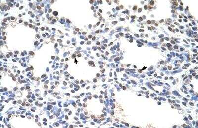 Immunohistochemistry-Paraffin: PIPPIN Antibody [NBP1-70673] - Human Lung Alveolar cells (indicated with arrows), 4-8ug/ml.